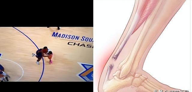 杰森·塔图姆_杰森·塔图姆 跟腱撕裂 NBA _ 塔图姆 跟腱断裂 康复 